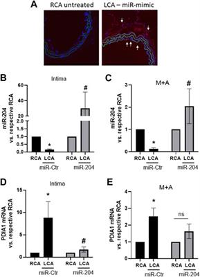 Disturbed flow regulates protein disulfide isomerase A1 expression via microRNA-204